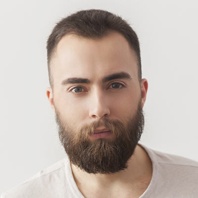 beard_transplant